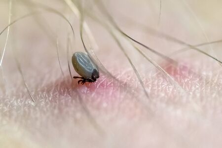 Small ixodes sucks blood on human skin. Close up viewの写真素材