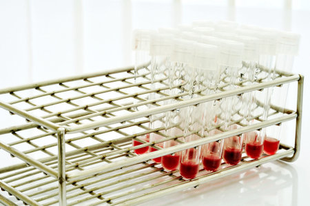 Blood sample in the rack