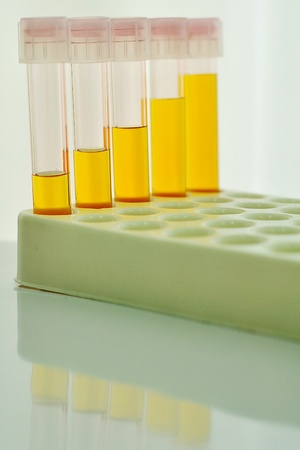 Test tubes with yellow reagentの写真素材
