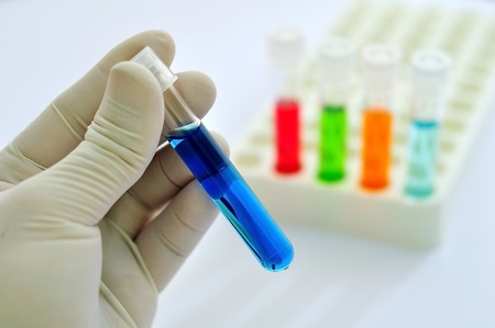 A medical technician holding a test tube of blue reagentの写真素材