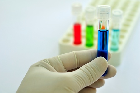 A medical technician holding a test tube of blue reagentの写真素材