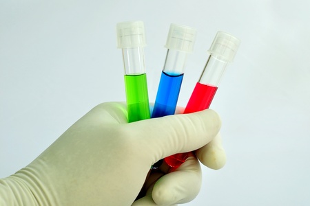 A medical technician holding a test tubes of reagentの写真素材
