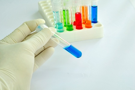 A lab technician holding a tube of blue solutionの写真素材