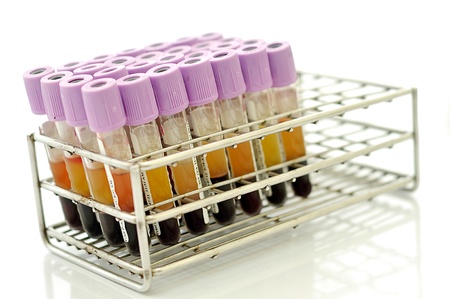 A row of blood sample in the rackの写真素材