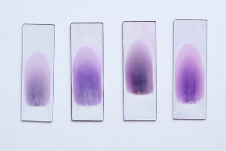 Blood film の写真素材