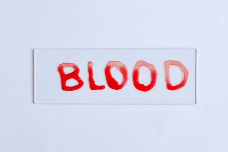 Blood slideの写真素材