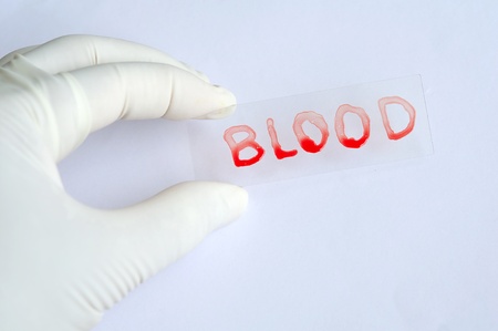 Blood slideの写真素材