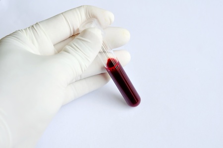 Blood sampleの写真素材