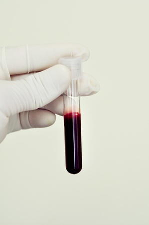 Blood sampleの写真素材