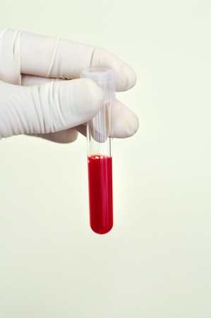 Blood sampleの写真素材