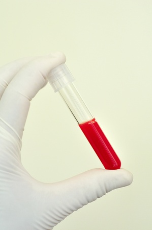 Blood sampleの写真素材
