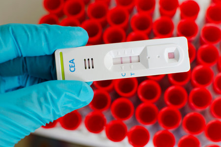 CEA tumor marker positive