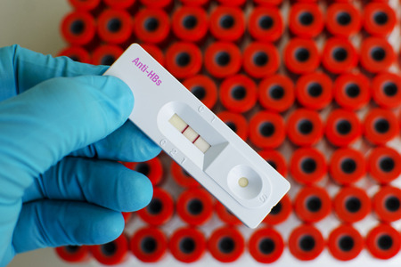 Anti-HBs Hepatitis B antibody positiveの写真素材