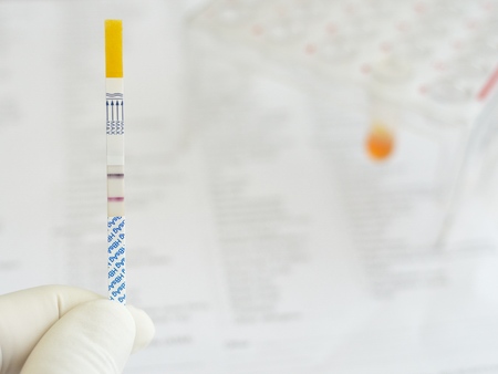 Hepatitis B virus positiveの写真素材