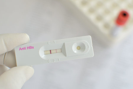 Anti-HBs positive