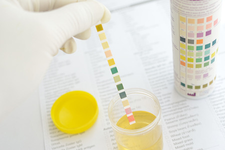 Urine analysisの写真素材