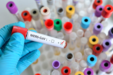 MERS virus positive