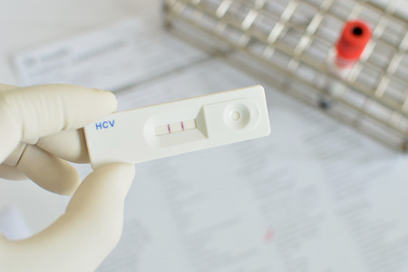 HCV positiveの写真素材