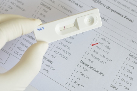 Hepatitis C negativeの写真素材