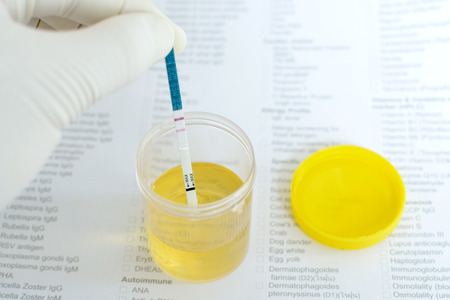 Urine pregnancy test positiveの写真素材
