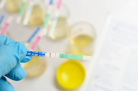 Urine analysisの写真素材