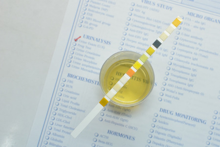 Urine analysisの写真素材