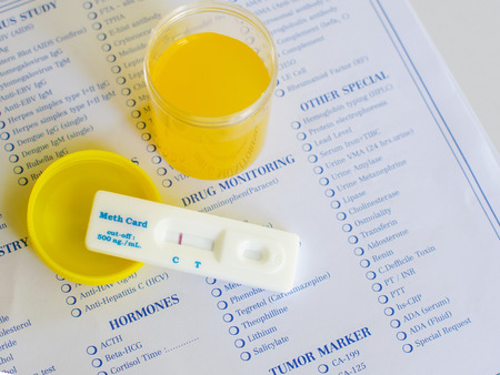 Urine methamphetamine positiveの写真素材