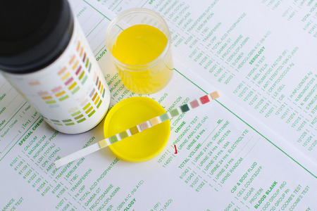 Urine examの写真素材
