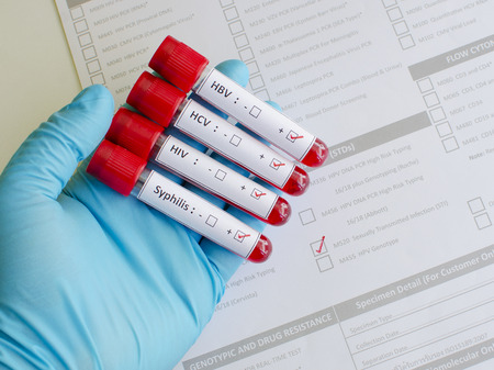 Sexually transmitted diseases: HIV, HBV, HCV, Syphilisの写真素材