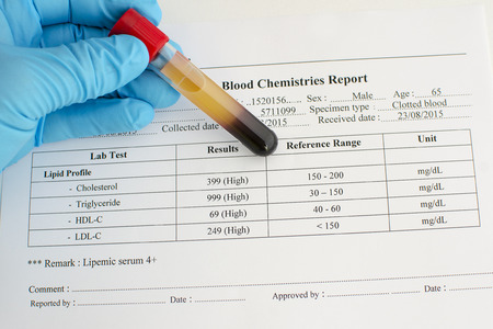 High lipid profile resultの写真素材