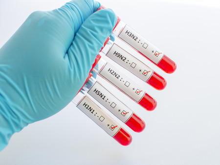 Influenza blood sampleの写真素材