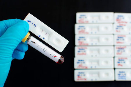 HIV testing positiveの写真素材