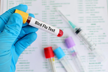 Blood for Bird Flu test