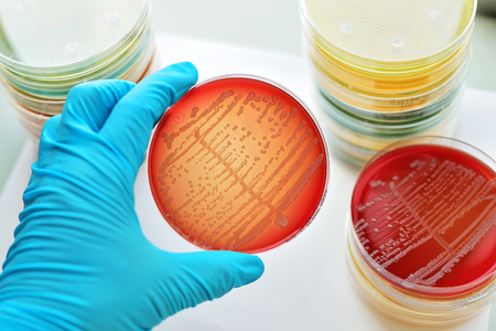 Colonies of bacteria in culture medium plateの写真素材