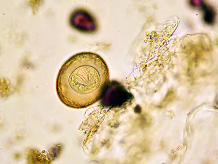 Egg of Hymenolepis diminuta (tapeworm) in stool, analyze by microscope