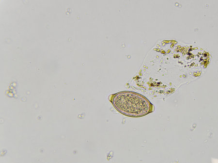 Egg of Trichuris trichiura in stool, analyze by microscope