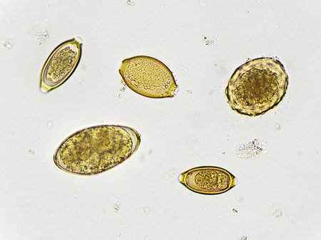 Eggs of helminth in stoolの写真素材