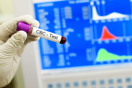 Blood for CBC testの写真素材