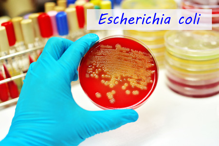Colonies of Escherichia coliの写真素材