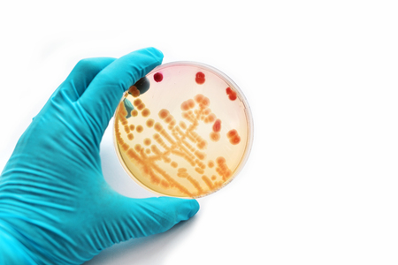Colonies of bacteria in petri dishの写真素材