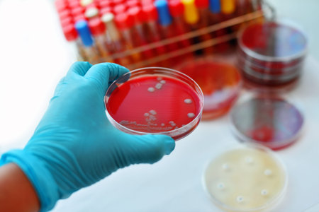 Colonies of bacteria in petri dish