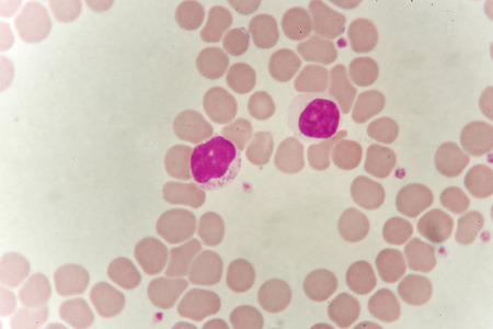 Lymphocyte cell in blood smearの写真素材
