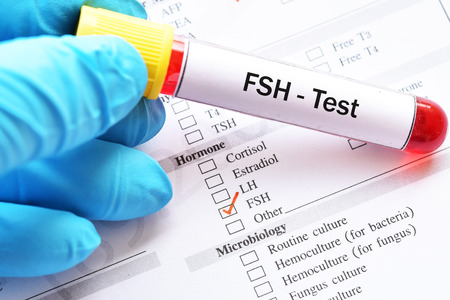 Blood sample for follicle stimulating hormone testの写真素材