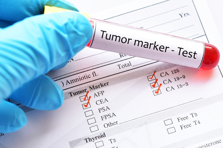Blood sample tube with laboratory requisition form for tumor marker testの写真素材