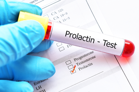 Blood sample tube with laboratory requisition form for prolactin hormone testの写真素材