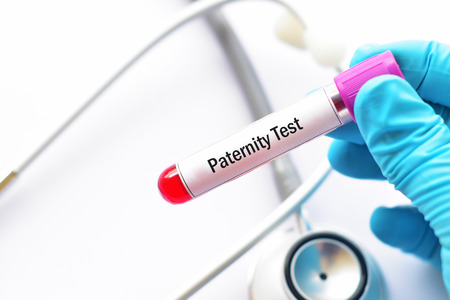 Test tube with blood sample for paternity testの写真素材