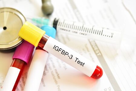 Blood sample tube for IGFBP-3 testの写真素材