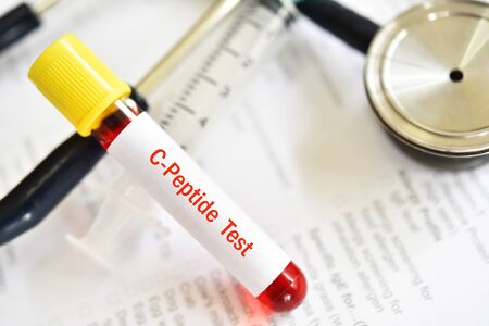 Blood sample tube for C-peptide testの写真素材