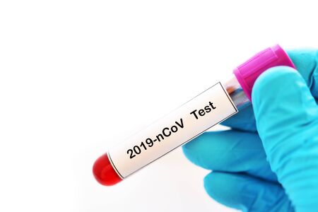 Blood sample tube for coronavirus 2019 testの写真素材