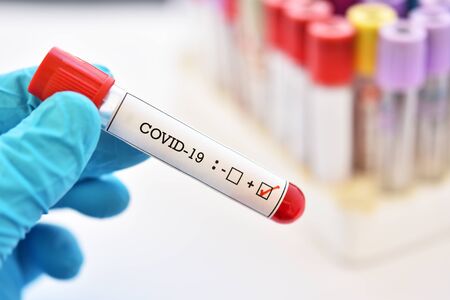 Blood sample tube positive with COVID-19 or novel coronavirusの写真素材